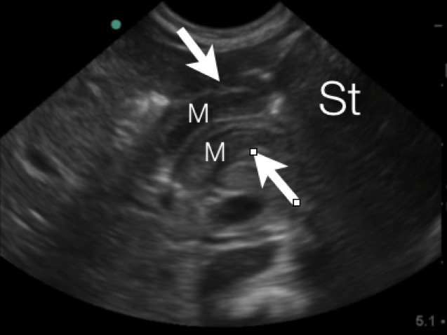 Figure 4a. Long axis view of the PM~2.JPG