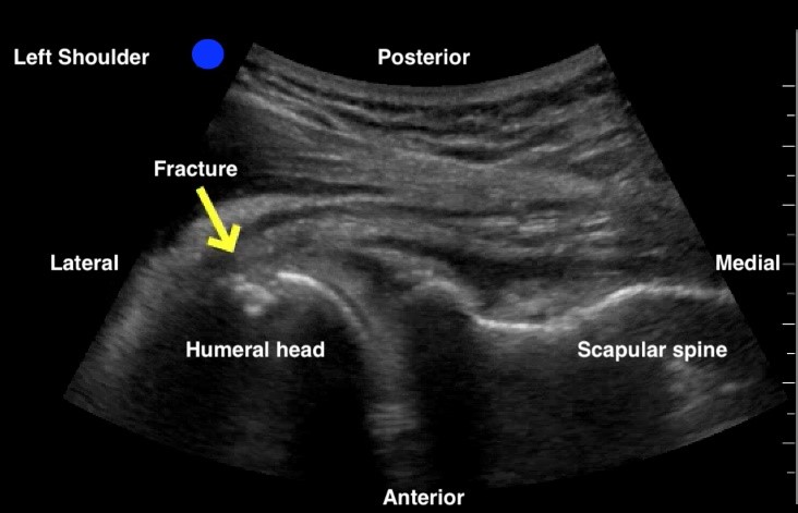 POCUS Image 4.jpg