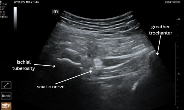 NovelTransFigure 1.jpg