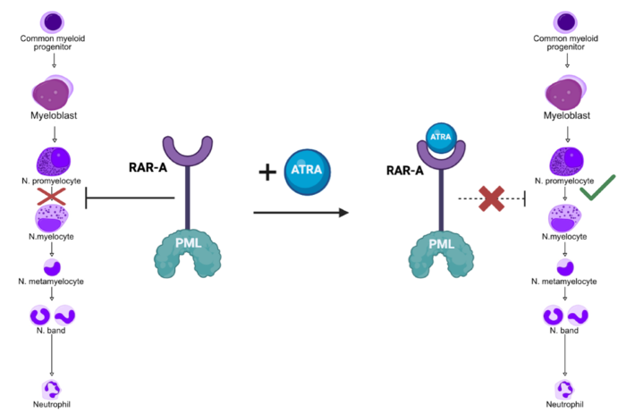AcutePromLeuk-Jan2025 (1).png