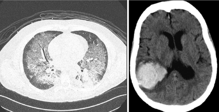 Hyperleuko-Jan 2025 (6).png