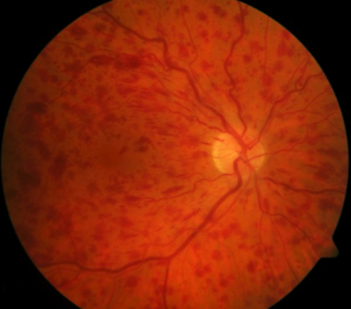 HyperViscosity Jan2025 (3).png