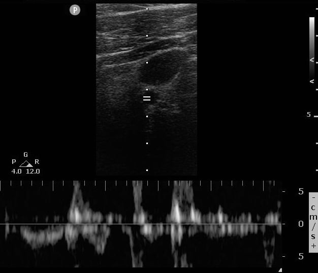 ACLS-Case 1 Img 1.jpg
