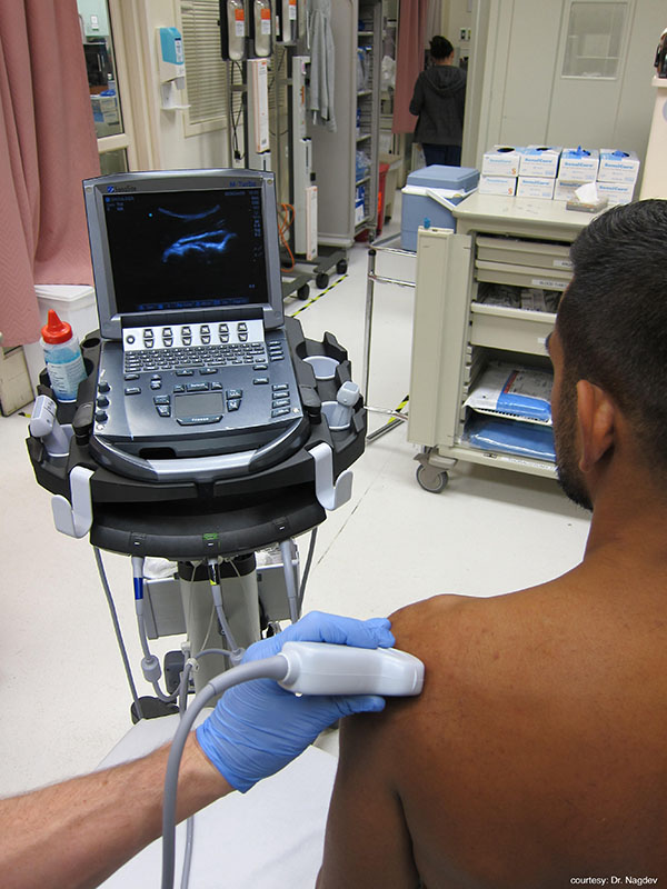 Figure 8 - Transducer placement for shoulder joint evaluation.jpg