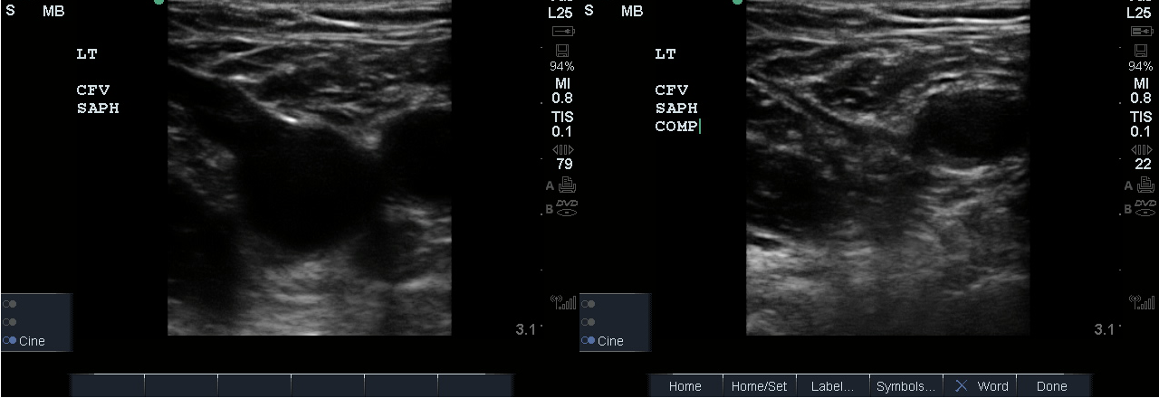 Figure 11. Visualze CFV and SV and compress .png