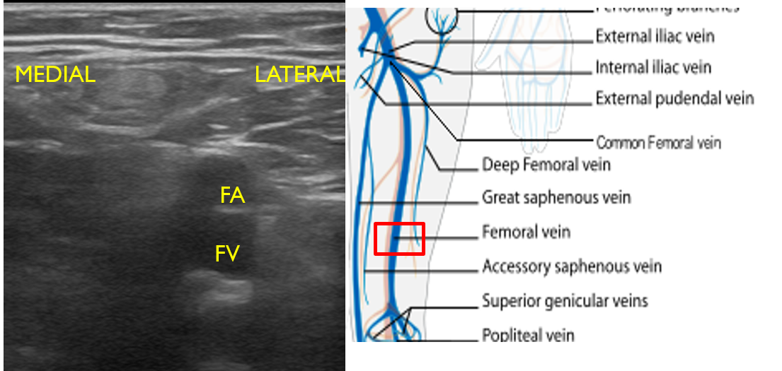 Figure 13 FA and FV.png