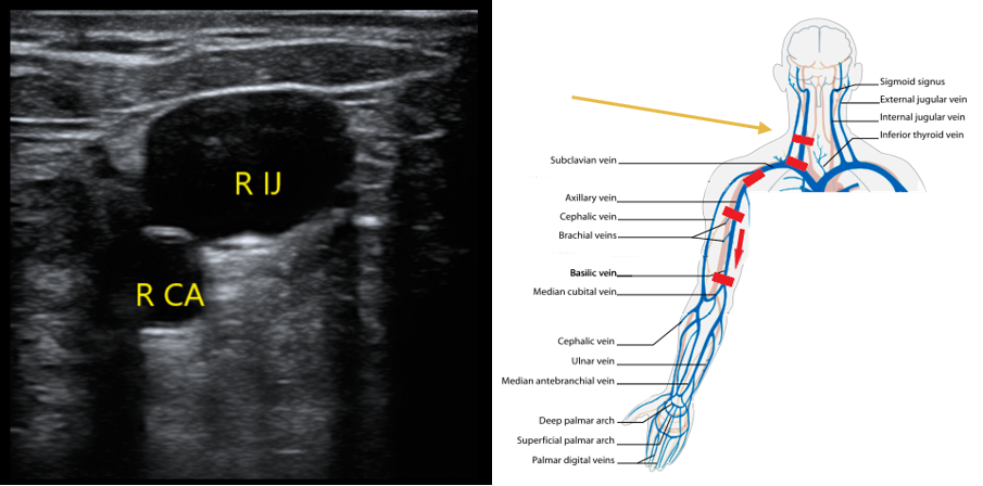 Figure 3 IJ scanning technique.png