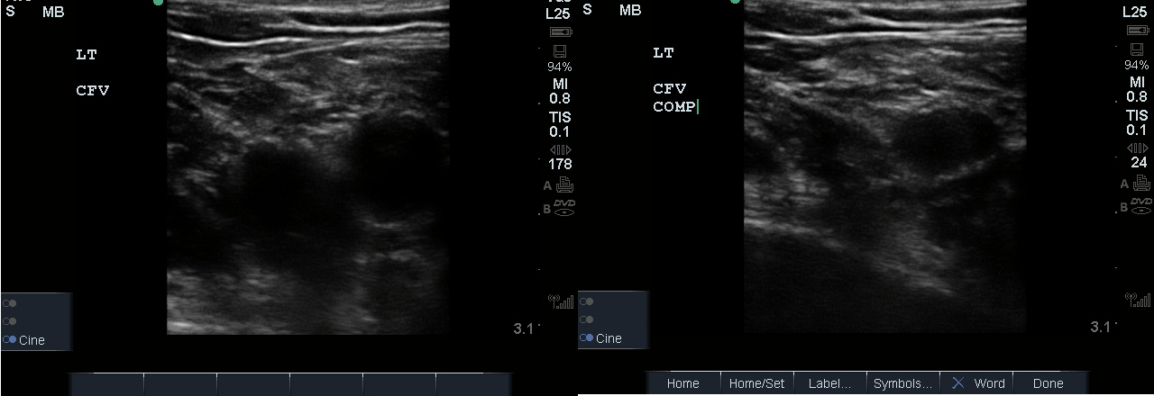 Figure 9. Visualize CFV and compress.png