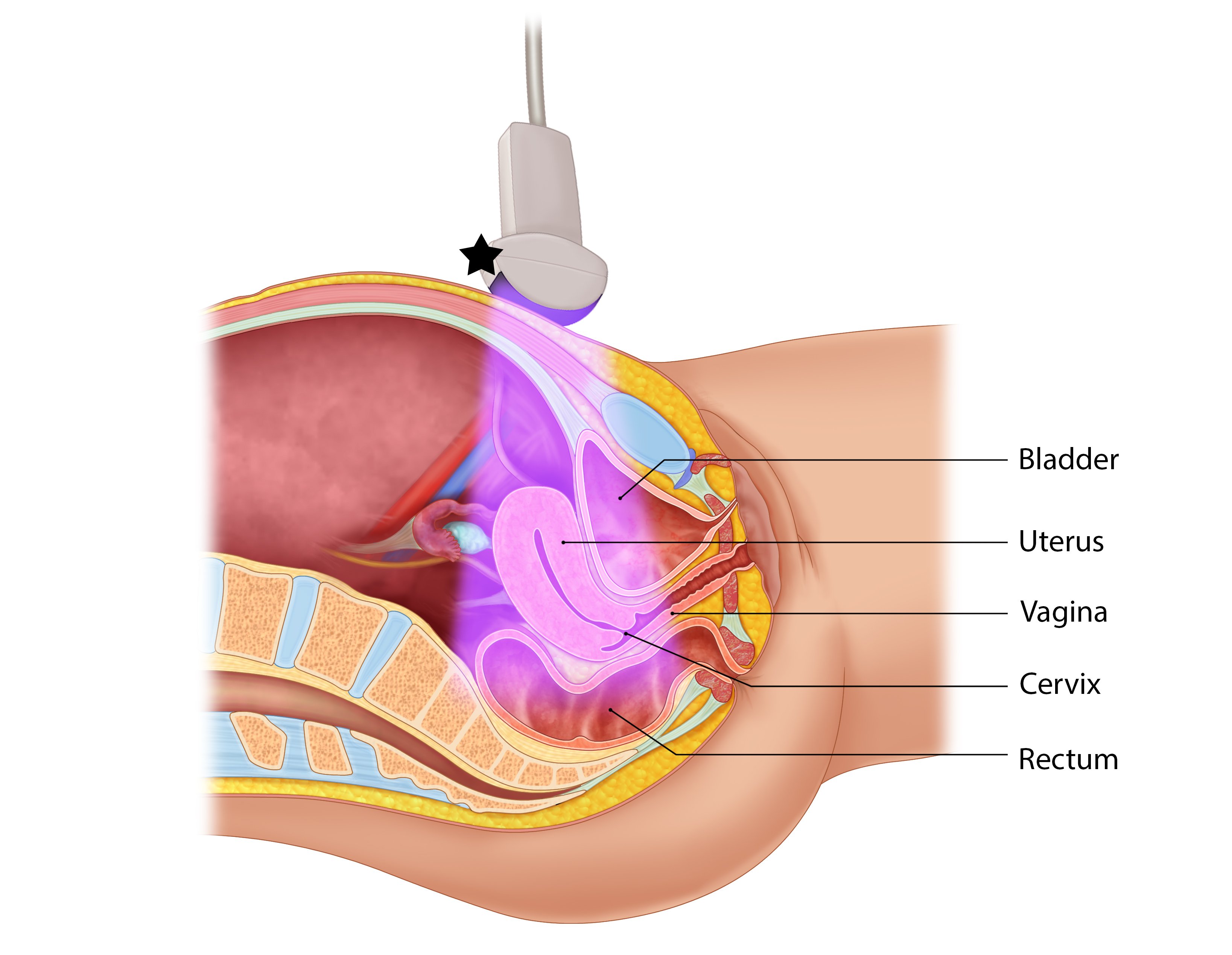 Illustration 3- Illustration of transverse approach and relevant anatomy. Probe indicator toward patient&rsquo;s right (star).jpg