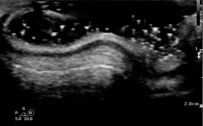 -Figure 1 - Normal Ear.jpg