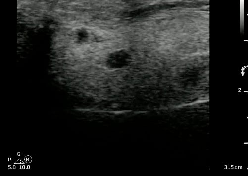 -Figure 19 - Parotid Lymph Nodes.jpg