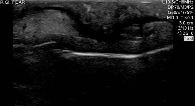 -Figure 3- Chondritis.jpg