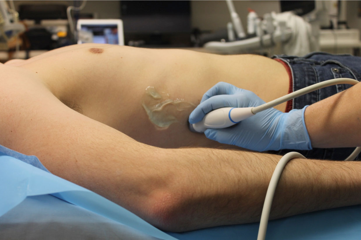 Figure 4 - Transducer position for RUQ view.jpg