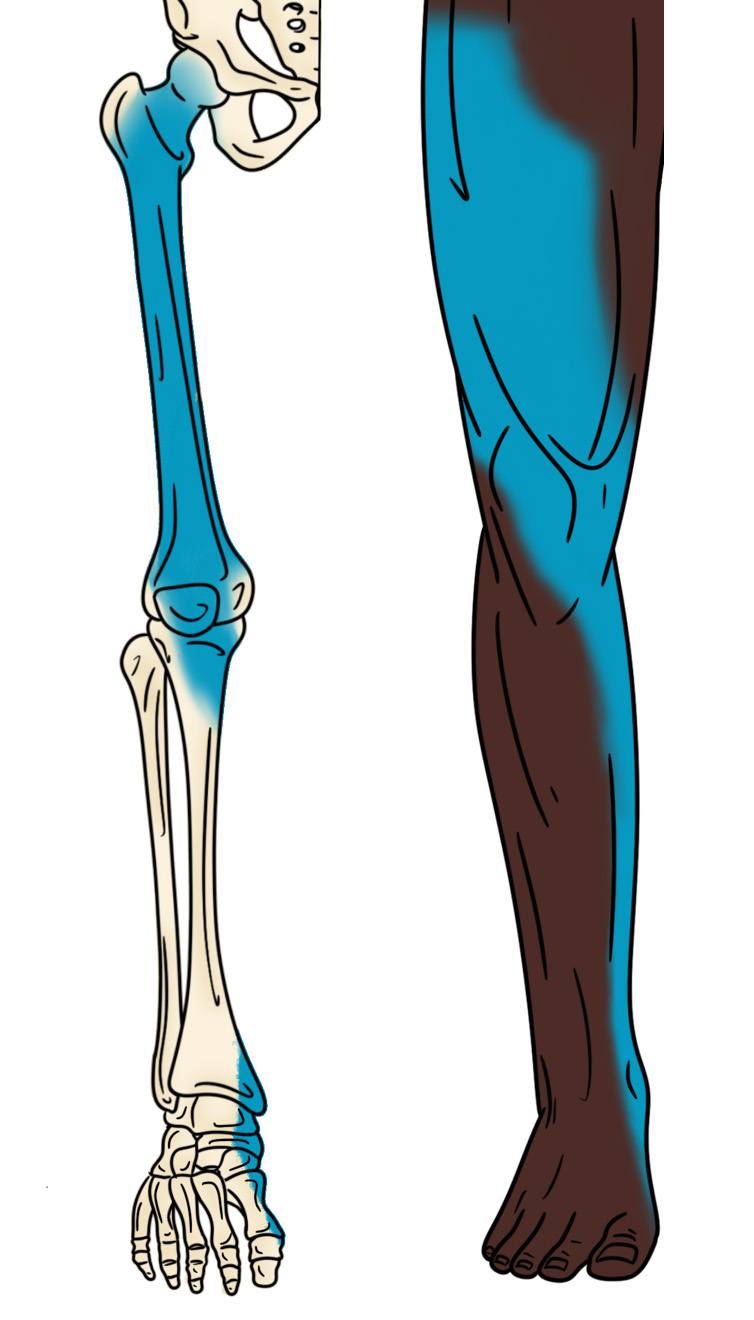 Illustration 2. Distribution of anesthesia for fascia iliaca block_.jpg