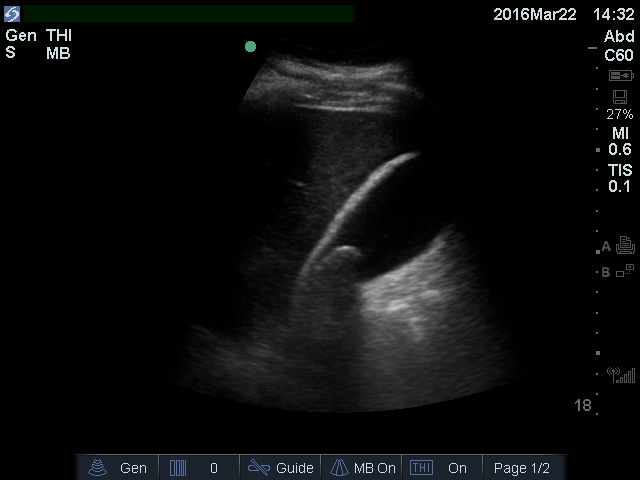 Figure 1-GB single stone neck.jpg