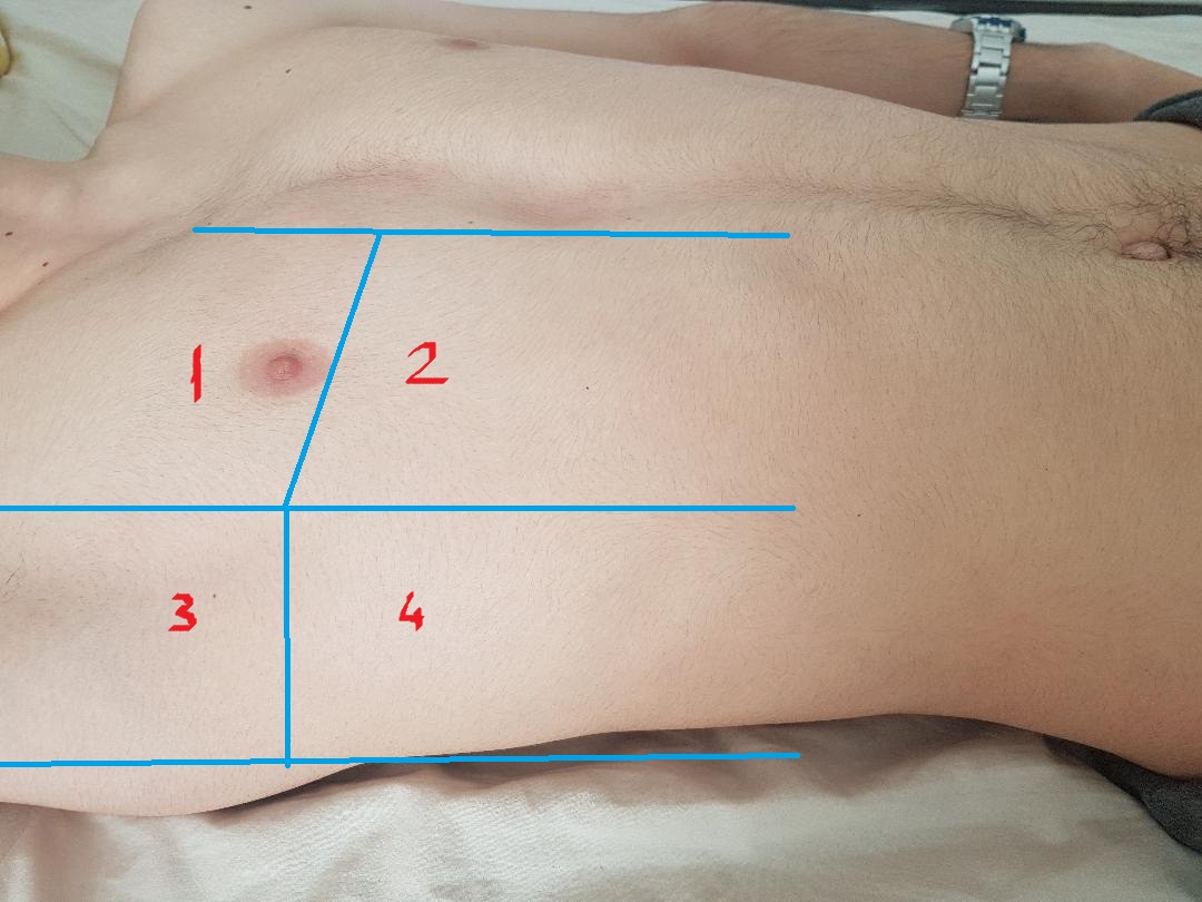 Image 12 - 8-zone protocol.jpg