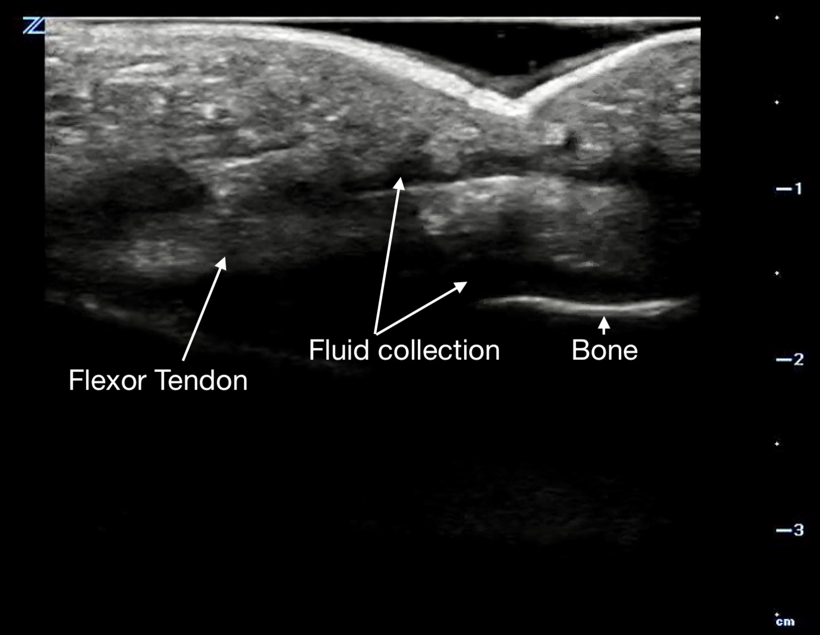 MSK-Figure 14b - FTS long.jpeg