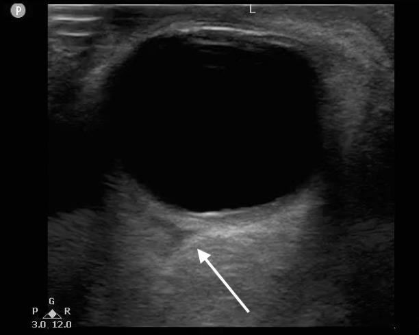 FIG 12 Guitar Pick Sign.jpg