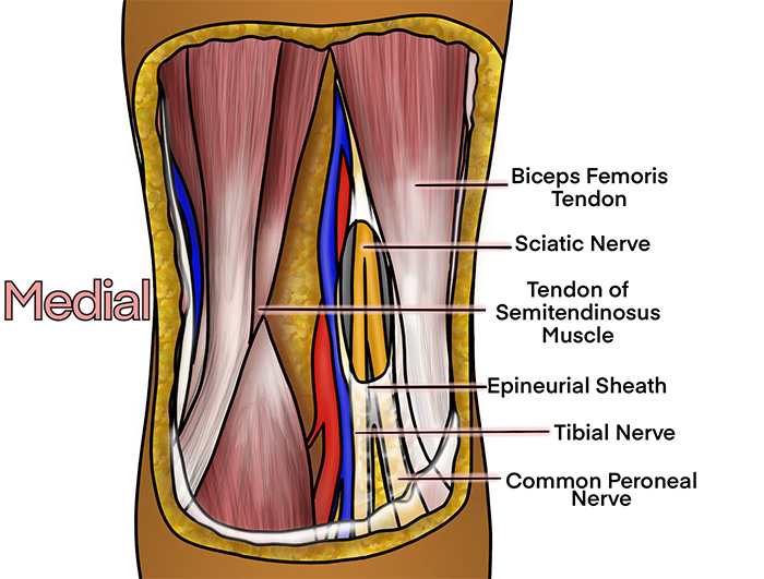 Illustration 2. Course of the Popliteal Sciatic Nerve.jpg