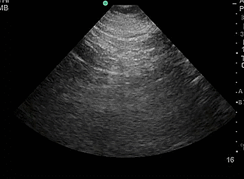 Video 8- Duplicate collecting system.gif