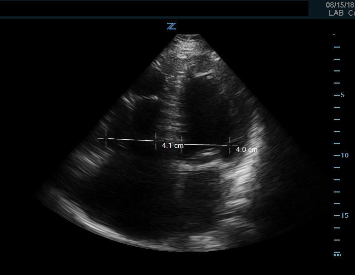 figure 9 - enlarged rv.jpg
