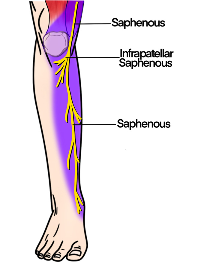 Illustration 2. Course of saphenous nerve.jpg