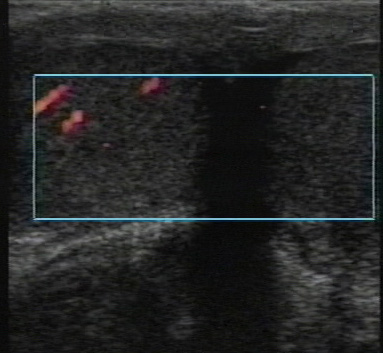 Figure 5_Power with torsion.jpg