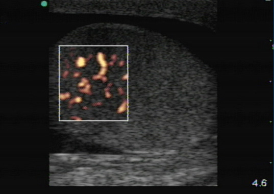 Figure 6_Orchitis.jpg