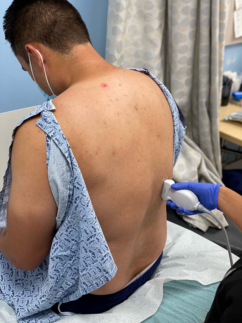 Thoracentesis Figure 2 - Patient in sitting position.jpg