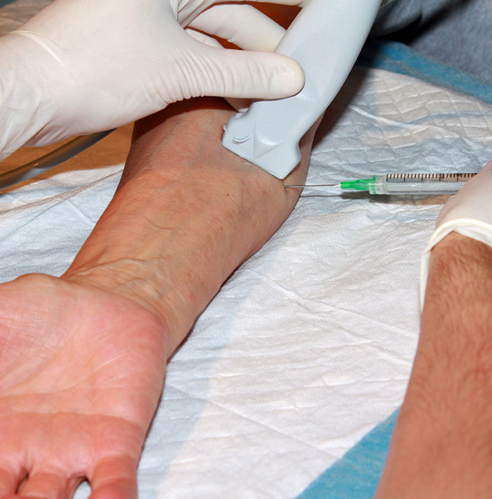 Figure 2. Hands for ulnar nerve forearm.jpg