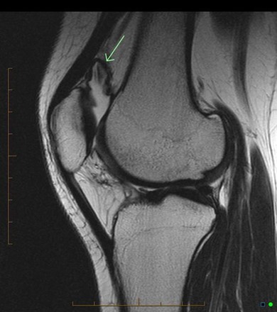 Dec22-Knee5.jpg