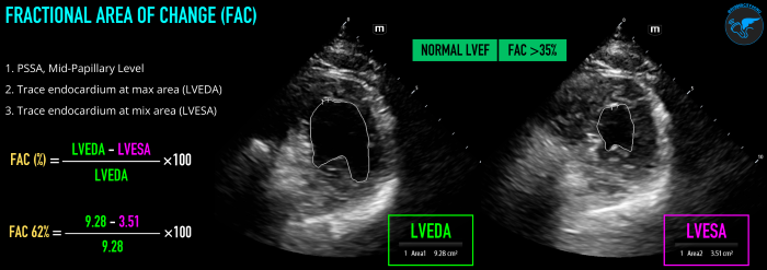 LVSF_Figure 4_Fractional Area of Change v2.png