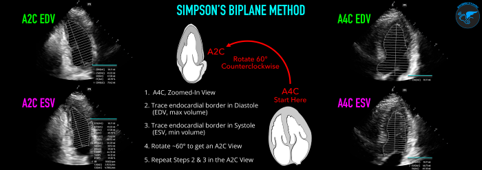 LVSF_Figure 5_Simpson's Biplane v3.png