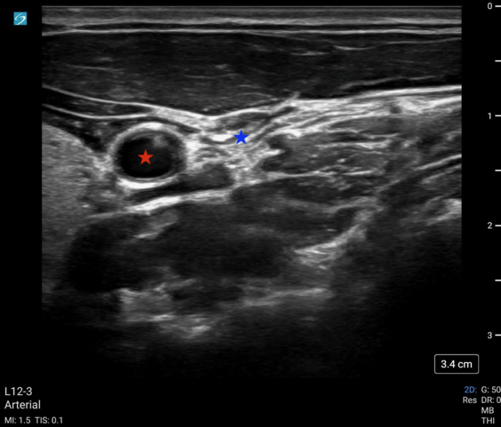 May2025Sonographic Fig 1 pocus cac.png