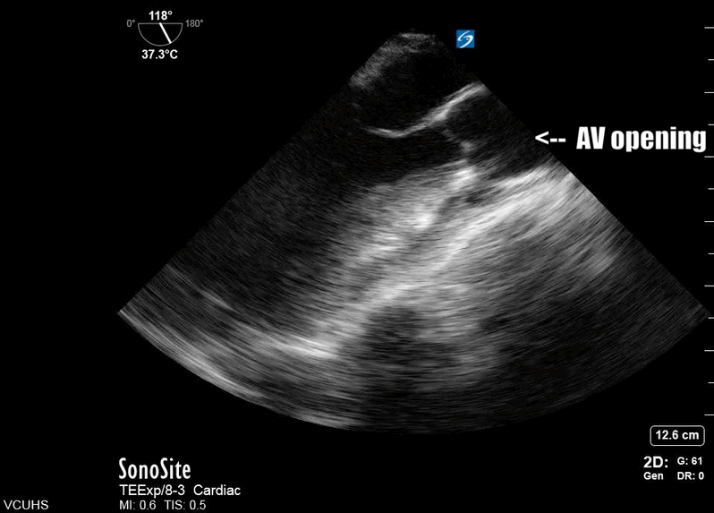 Stay'nAlive ME-LAX figure2.gif