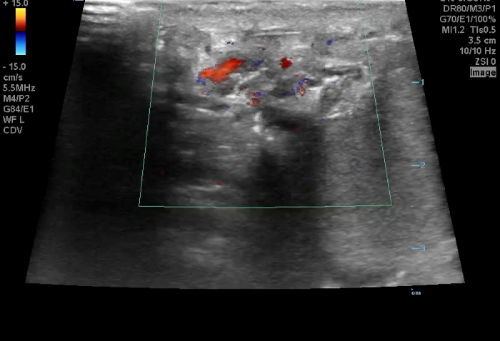 Torsion - image 2.png