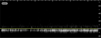 Torsion - image 7.png