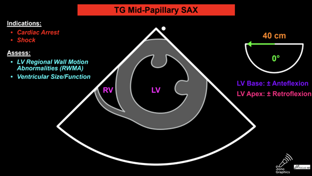 Transgastric_Figure 1.png