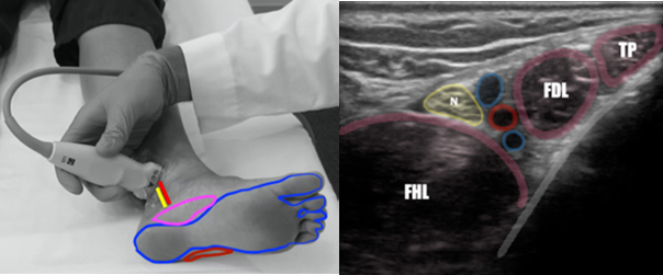 Use of POCUS_Figure 1 r-l.png