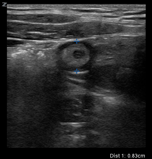 appy measurement.jpg